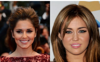 Celebrities Before and After Veneers