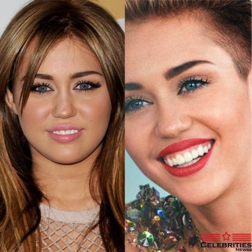 Miley Cyrus teeth