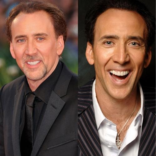 Nicolas Cage teeth